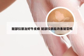 腿部拉筋治好牛皮癣 腿部拉筋能改善腿型吗