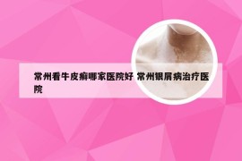 常州看牛皮癣哪家医院好 常州银屑病治疗医院