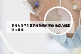 免疫力低下引起的皮肤病有哪些 免疫力低出现皮肤病