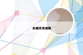 白癜风发病期