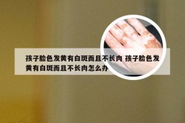 孩子脸色发黄有白斑而且不长肉 孩子脸色发黄有白斑而且不长肉怎么办