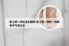 脸上黑一块白怎么回事 脸上黑一块白一块肤色不均怎么办
