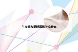 牛皮癣大量脱屑该补充什么