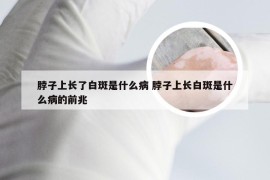 脖子上长了白斑是什么病 脖子上长白斑是什么病的前兆