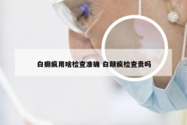 白癫疯用啥检查准确 白颠疯检查贵吗