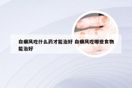 白癞风吃什么药才能治好 白癞风吃哪些食物能治好