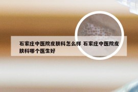 石家庄中医院皮肤科怎么样 石家庄中医院皮肤科哪个医生好