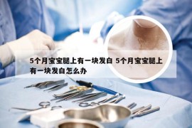 5个月宝宝腿上有一块发白 5个月宝宝腿上有一块发白怎么办