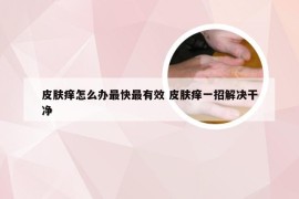 皮肤痒怎么办最快最有效 皮肤痒一招解决干净