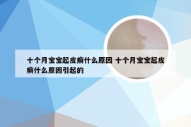 十个月宝宝起皮癣什么原因 十个月宝宝起皮癣什么原因引起的