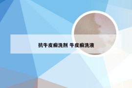 抗牛皮癣洗剂 牛皮癣洗液