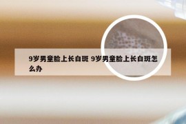 9岁男童脸上长白斑 9岁男童脸上长白斑怎么办
