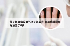 得了银屑病没勇气活了怎么办 银屑病就没有办法治了吗?