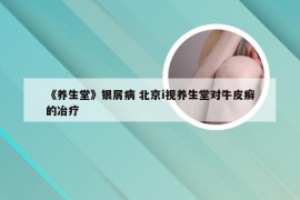 《养生堂》银屑病 北京i视养生堂对牛皮癣的冶疗