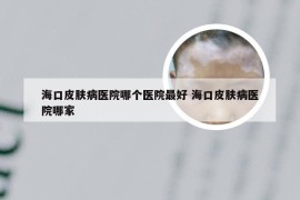 海口皮肤病医院哪个医院最好 海口皮肤病医院哪家