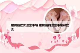 银屑病饮食注意事项 银屑病的注意事项和饮食