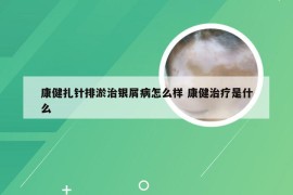 康健扎针排淤治银屑病怎么样 康健治疗是什么