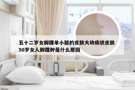 五十二岁女脚踝单小腿的皮肤大块癍状皮肤 50岁女人脚踝肿是什么原因