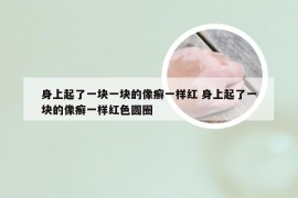 身上起了一块一块的像癣一样红 身上起了一块的像癣一样红色圆圈
