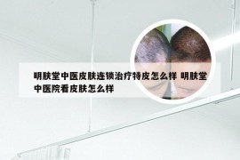 明肤堂中医皮肤连锁治疗特皮怎么样 明肤堂中医院看皮肤怎么样