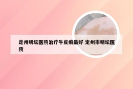 定州明坛医院治疗牛皮癣最好 定州市明坛医院