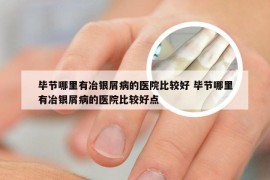 毕节哪里有冶银屑病的医院比较好 毕节哪里有冶银屑病的医院比较好点