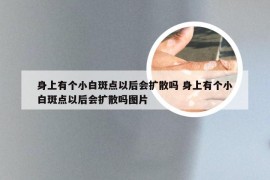 身上有个小白斑点以后会扩散吗 身上有个小白斑点以后会扩散吗图片