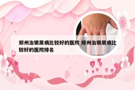 郑州治银屑病比较好的医院 郑州治银屑病比较好的医院排名