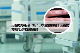 云南优克制药厂生产三珍清紫椒癣酊 云南优克制药公司紫椒癣酊