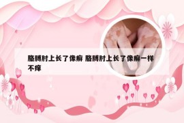 胳膊肘上长了像癣 胳膊肘上长了像癣一样 不痒