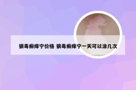 狼毒癣痒宁价格 狼毒癣痒宁一天可以涂几次