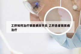 乙肝如何治疗银屑病关节炎 乙肝患者银屑病治疗