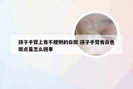 孩子手臂上有不规则的白斑 孩子手臂有白色斑点是怎么回事