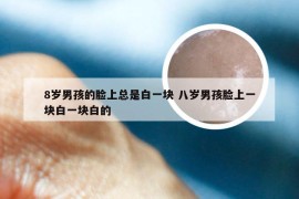 8岁男孩的脸上总是白一块 八岁男孩脸上一块白一块白的