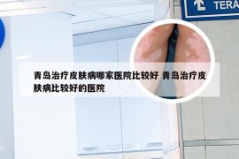 青岛治疗皮肤病哪家医院比较好 青岛治疗皮肤病比较好的医院