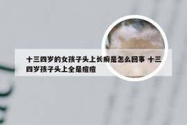 十三四岁的女孩子头上长癣是怎么回事 十三四岁孩子头上全是痘痘