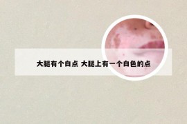 大腿有个白点 大腿上有一个白色的点