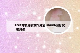 UVB对银屑病没作用滴 nbuvb治疗仪 银屑病