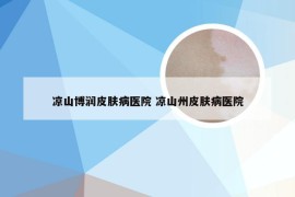 凉山博润皮肤病医院 凉山州皮肤病医院