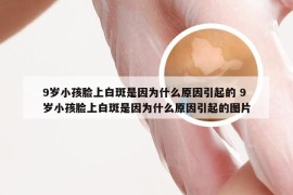 9岁小孩脸上白斑是因为什么原因引起的 9岁小孩脸上白斑是因为什么原因引起的图片