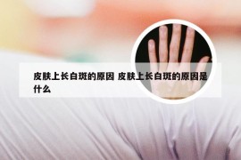 皮肤上长白斑的原因 皮肤上长白斑的原因是什么