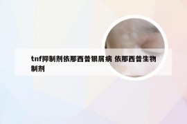tnf抑制剂依那西普银屑病 依那西普生物制剂
