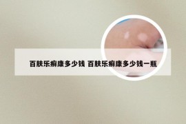 百肤乐癣康多少钱 百肤乐癣康多少钱一瓶