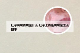 肚子有块白斑是什么 肚子上白色斑块是怎么回事