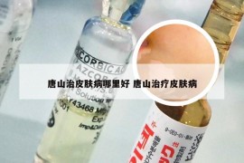 唐山治皮肤病哪里好 唐山治疗皮肤病
