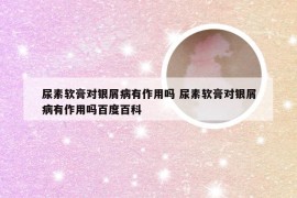 尿素软膏对银屑病有作用吗 尿素软膏对银屑病有作用吗百度百科