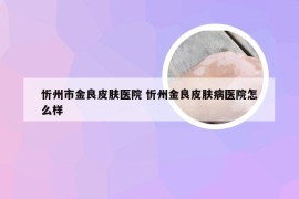 忻州市金良皮肤医院 忻州金良皮肤病医院怎么样