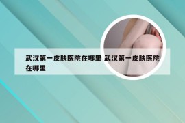 武汉第一皮肤医院在哪里 武汉第一皮肤医院在哪里
