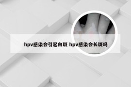 hpv感染会引起白斑 hpv感染会长斑吗