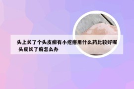 头上长了个头皮癣有小疙瘩用什么药比较好呢 头皮长了癣怎么办